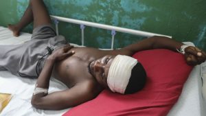 Germain Rivaldo, wounded by a bullet during armed gang attacks, lies on a bed at Saint Nicolas hospital in Saint-Marc, Haiti, Sunday, Oct. 6, 2024.